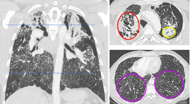 Contrast-enhanced chest computed tomography (CT)